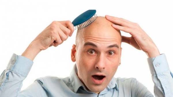 Эркакларда соч тўкилишининг янги сабаби аниқланди
