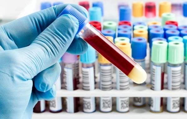 Саратонга энг бардошли қон гуруҳи аниқланди